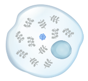 Morquio A cell with GAG buildup 